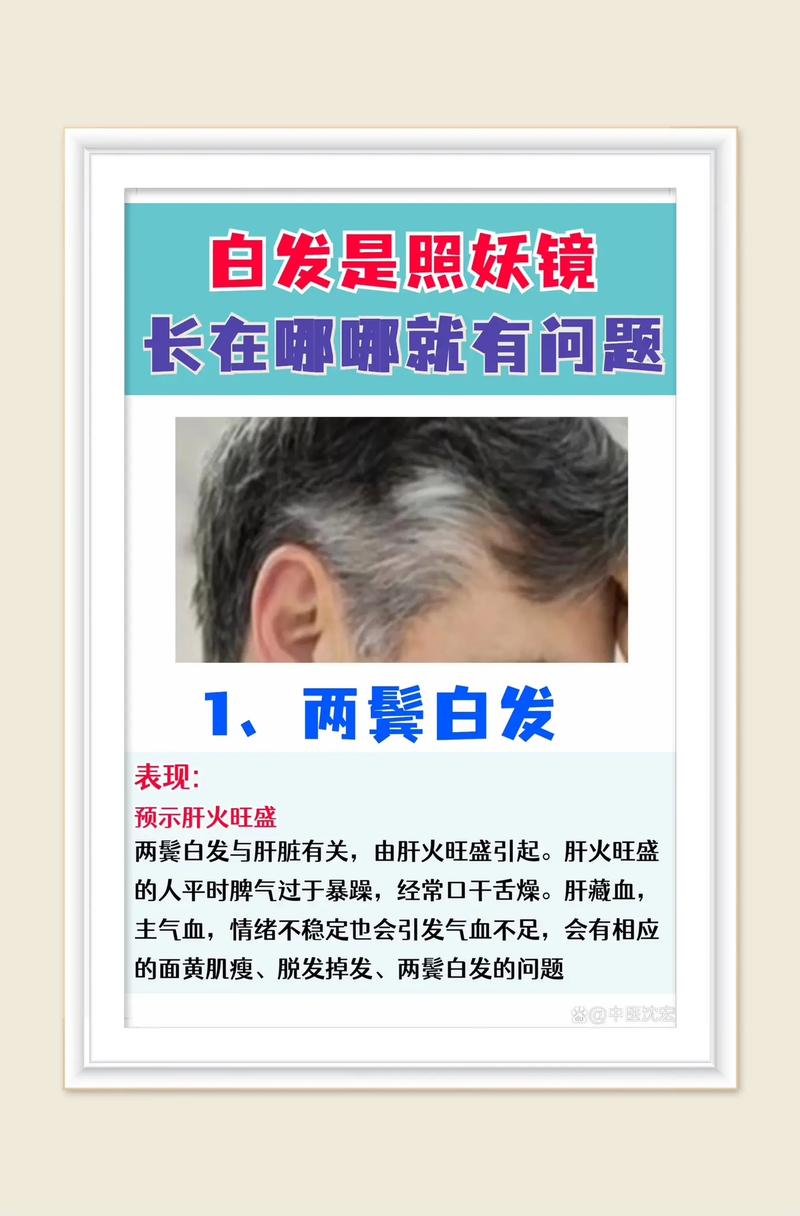 为什么有白头发(为什么会有白头发原因是什么)