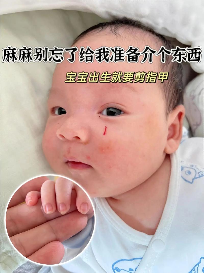 新生儿指甲多久可以剪(新生儿指甲多久可以剪一下)