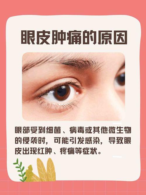 眼角为什么会肿(眼角为什么会肿有点疼)