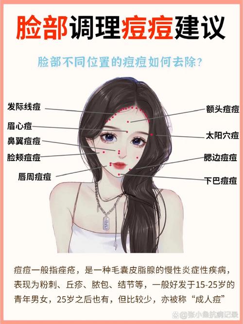 长痘痘的原因有哪些(痘痘怎么才能快速消除)